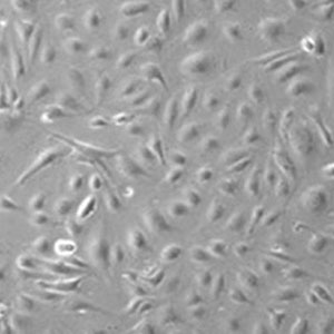 upcyte®  microvascular endothelial cells