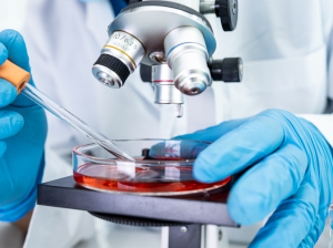 Access Human Biological Samples for Your Oncology Research!