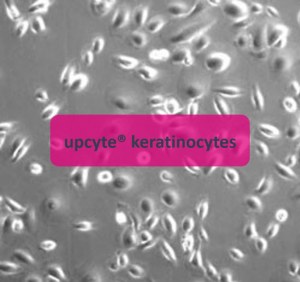 keratinocytes