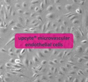 Microvascular endothelial cells